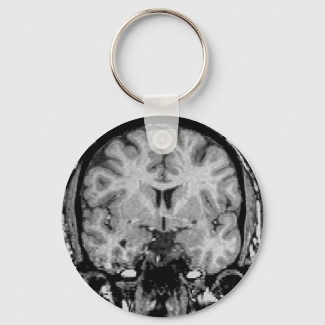 Brain MRI, coronal slice Key Ring (Front)