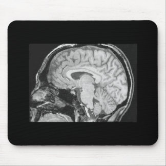 Brain MRI Mouse Mat
