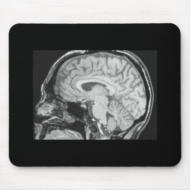 Brain MRI Mouse Mat (Front)