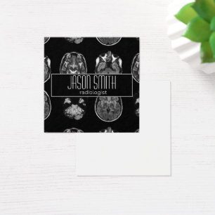 Brain MRI scan