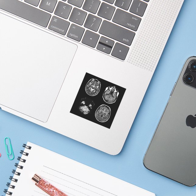 Brain MRI scan (Laptop w/ iPhone)