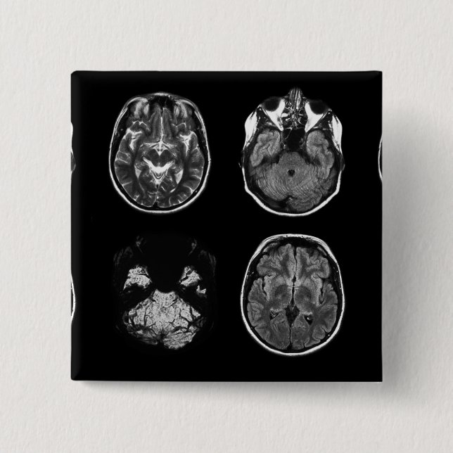 Brain MRI scan 15 Cm Square Badge (Front)