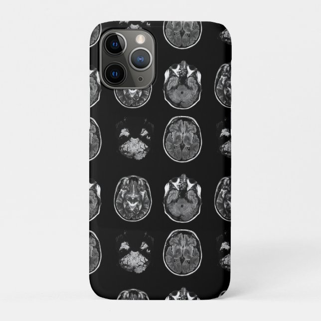 Brain MRI scan Case-Mate iPhone Case (Back)