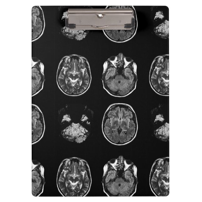 Brain MRI scan Clipboard (Front)