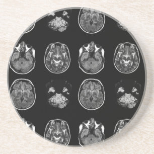 Brain MRI scan Coaster