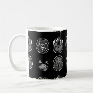 Brain MRI scan Coffee Mug