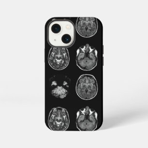 Brain MRI scan iPhone 13 Mini Case