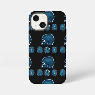 Brain Mri scan iPhone 13 Mini Case