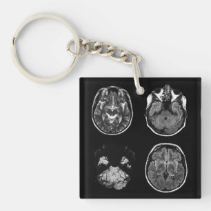 Brain MRI scan Key Ring