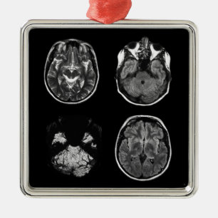 Brain MRI scan Metal Tree Decoration
