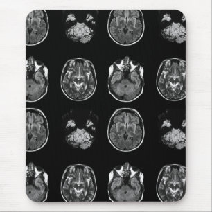 Brain MRI scan Mouse Mat
