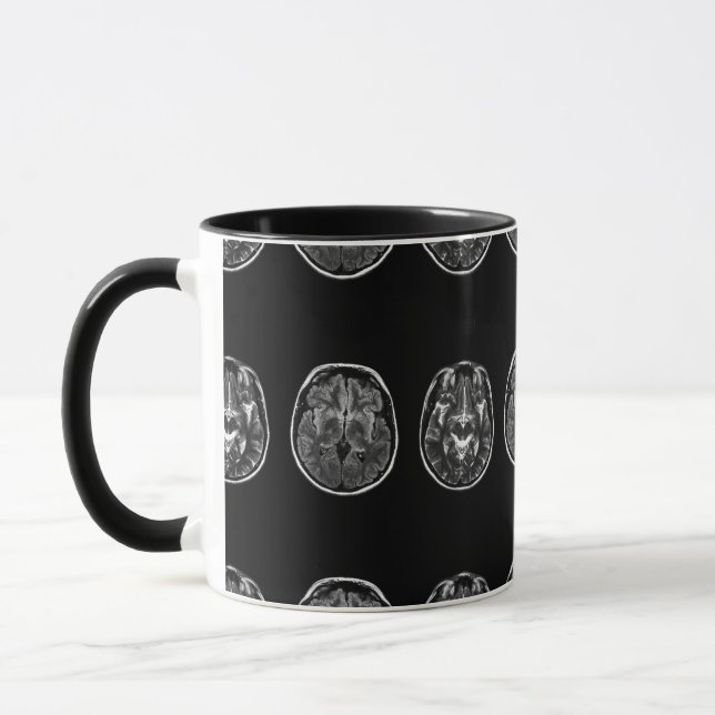 Brain mri scan mug (Left)