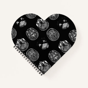 Brain MRI scan Notebook