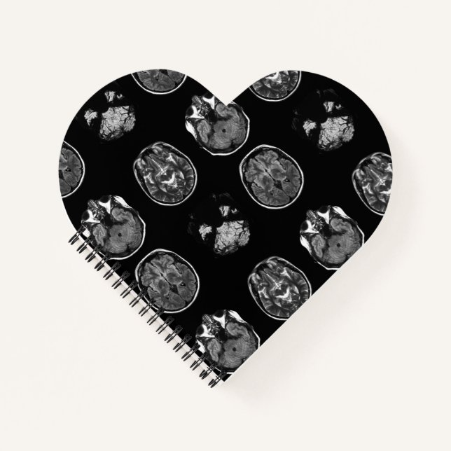 Brain MRI scan Notebook (Front)