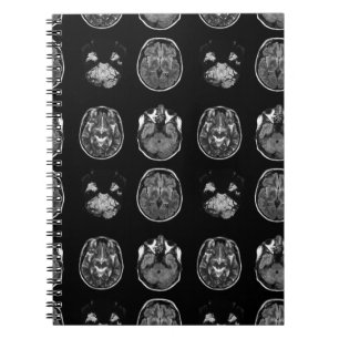 Brain MRI scan Notebook