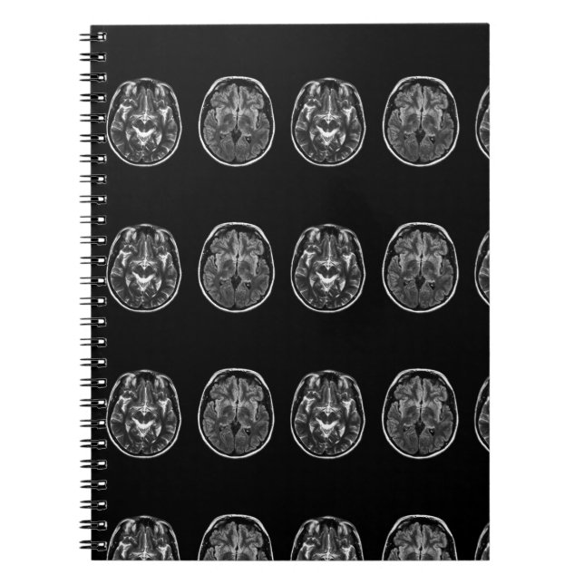 Brain mri scan notebook (Front)