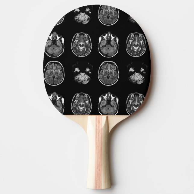 Brain MRI scan Ping Pong Paddle (Front)