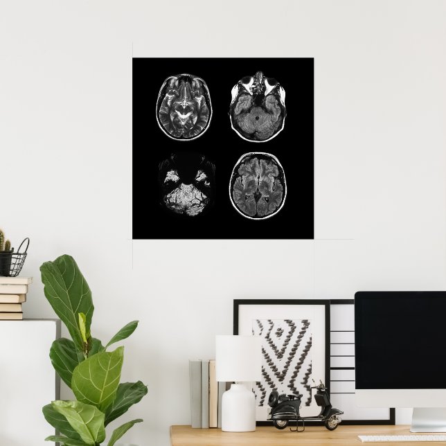Brain MRI scan Poster (Home Office)