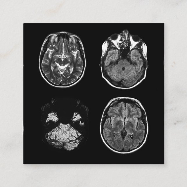 Brain MRI scan Square Business Card (Front)