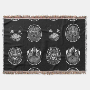 Brain MRI scan Throw Blanket