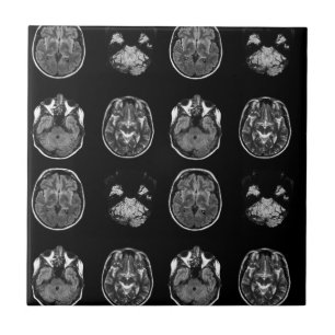 Brain MRI scan Tile
