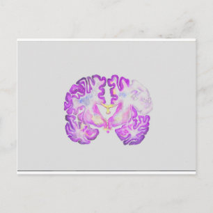 Brain Postcard