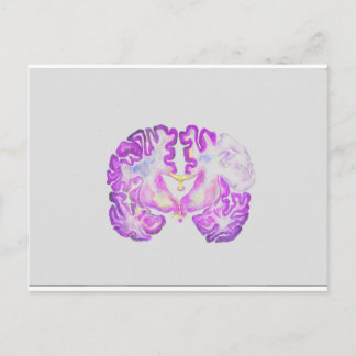Brain Postcard