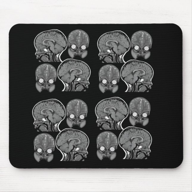 BRAINS! (MRI) MOUSE MAT (Front)