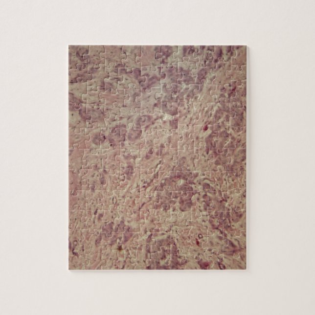 Breast cancer under the microscope jigsaw puzzle (Vertical)