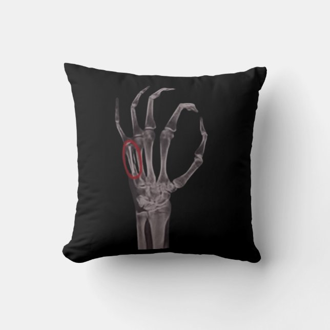 Broken Bones Hands Skeleton X-RAY T-Shirt Cushion (Front)