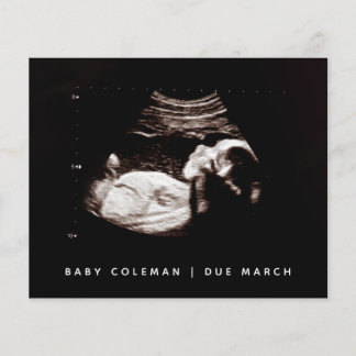 Budget Pregnancy Baby Sonogram Ultrasound Photo
