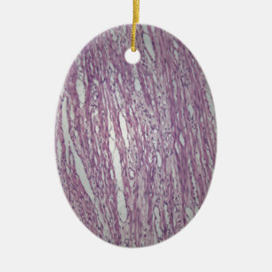 Cells of human uterus tissue with inoffensive tumo ceramic tree decoration