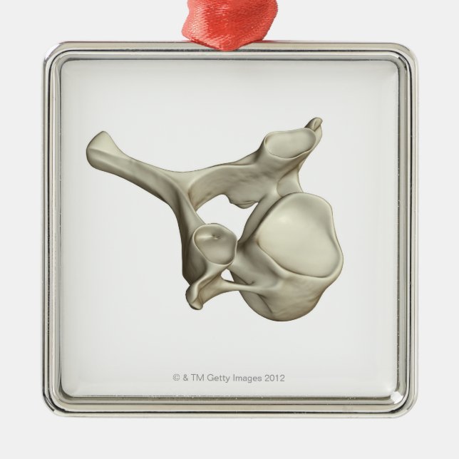 Cervical Vertebra Metal Tree Decoration (Front)
