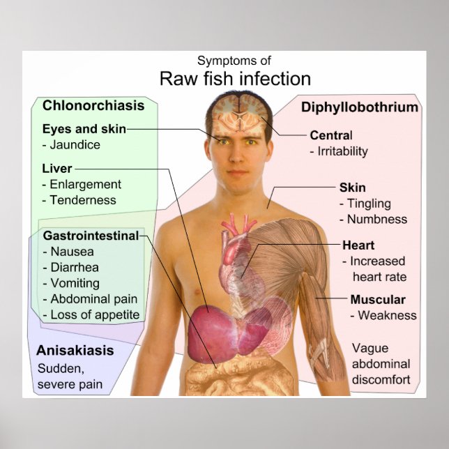 Chart of Symptoms of a Raw Fish Infection (Front)