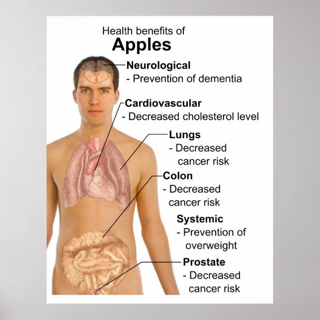 Chart of the Health Benefits of Eating Apples (Front)