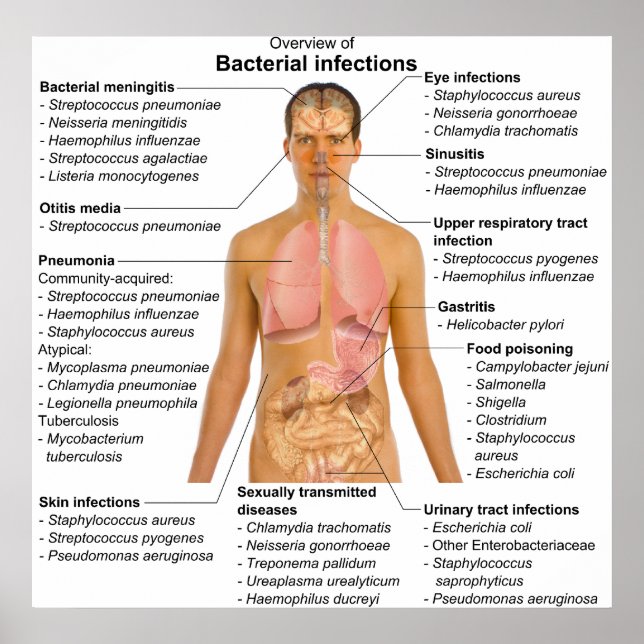 Chart of the Main Bacterial Infections in Humans (Front)