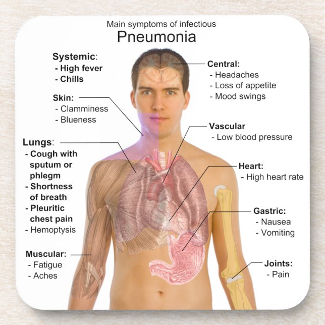 Chart of the Symptoms of Pneumonia Coaster (Front)