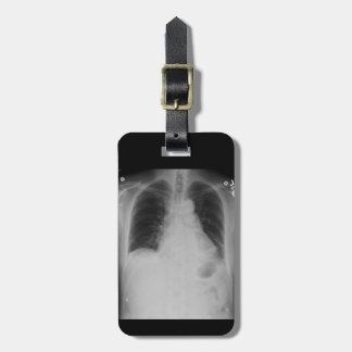 Chest X Ray ~ Luggage tag