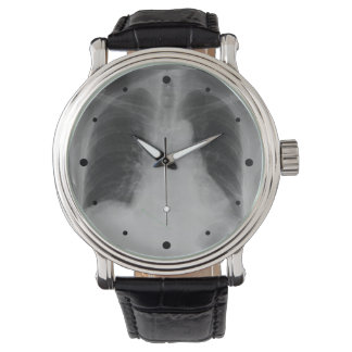 Chest X Ray ~ watch