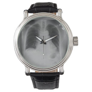 Chest X Ray ~ watch
