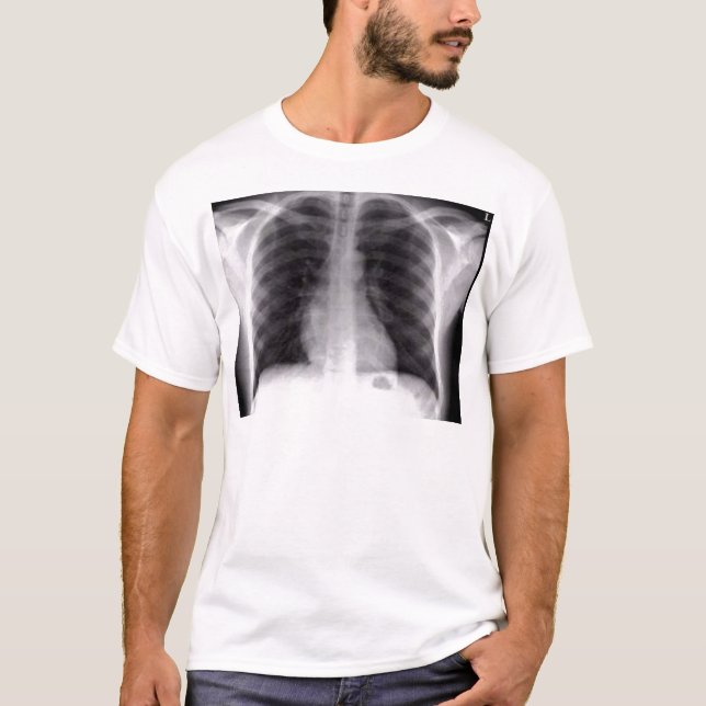 chest xray T-Shirt (Front)