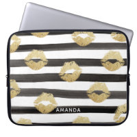 Chic Gold Glitter Lips & Black Stripes Monogram