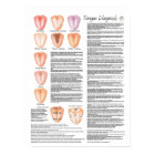 Chinese Tongue Diagnosis Acupuncture Poster