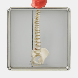 Chiropractic skeleton metal tree decoration