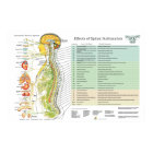 Chiropractic Subluxation Spinal Nerves ANS Chart