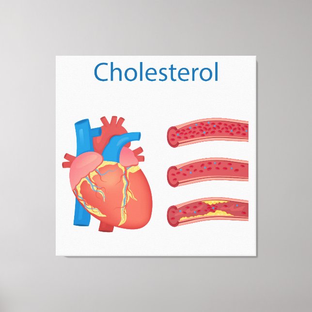 Cholesterol Canvas Print (Front)
