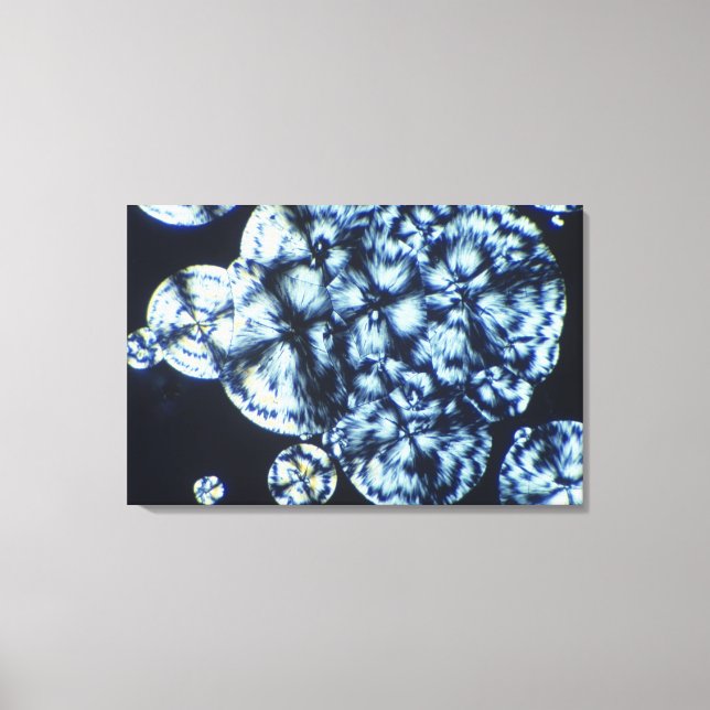 Cholesterol Crystals Viewed in Polarised Light Canvas Print (Front)
