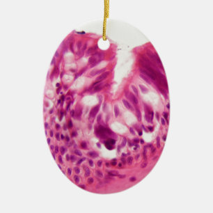 Ciliated epithelium under the microscope. ceramic tree decoration