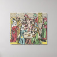 Circumcision
