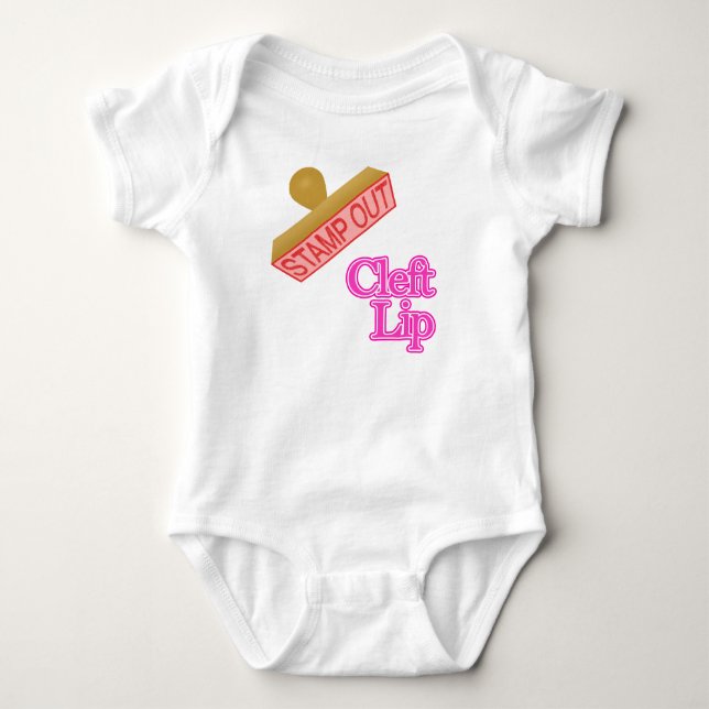 cleft lip baby bodysuit (Front)